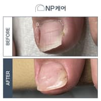 엔피케어 대전서구점 로고