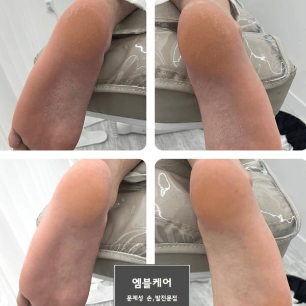 [울산] 엠블케어