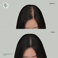 스칼프라임 로고