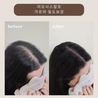 리오시스칼프 로고