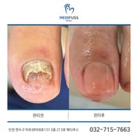 메디푸스 로고