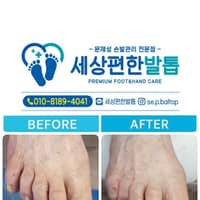 세상편한발톱 로고